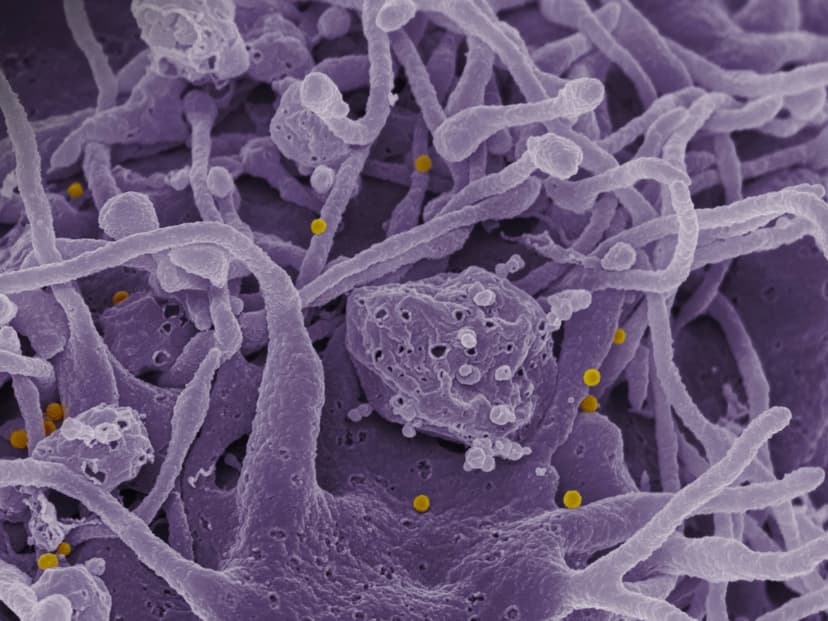 GI Map Test Explained: What Your Doctor Isn't Telling You About Gut Health